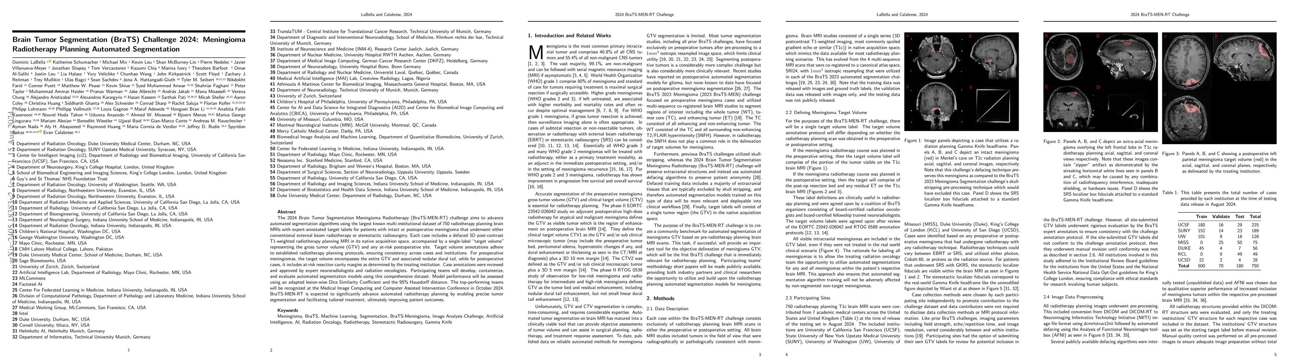 Thumbnail for Brain Tumor Segmentation (BraTS) Challenge 2024: Meningioma Radiotherapy
  Planning Automated Segmentation