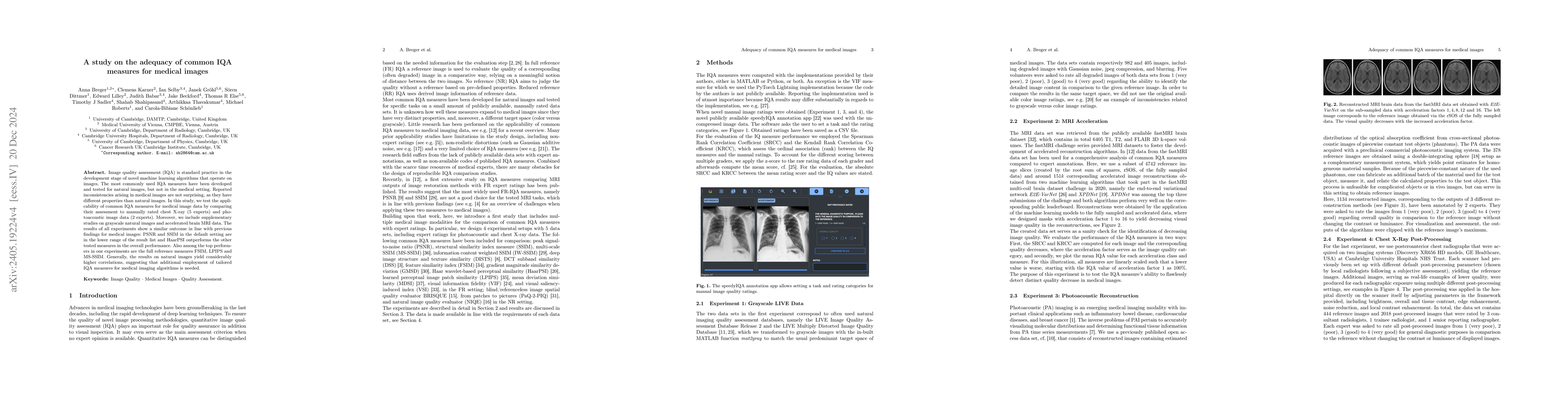 Thumbnail for A study on the adequacy of common IQA measures for medical images