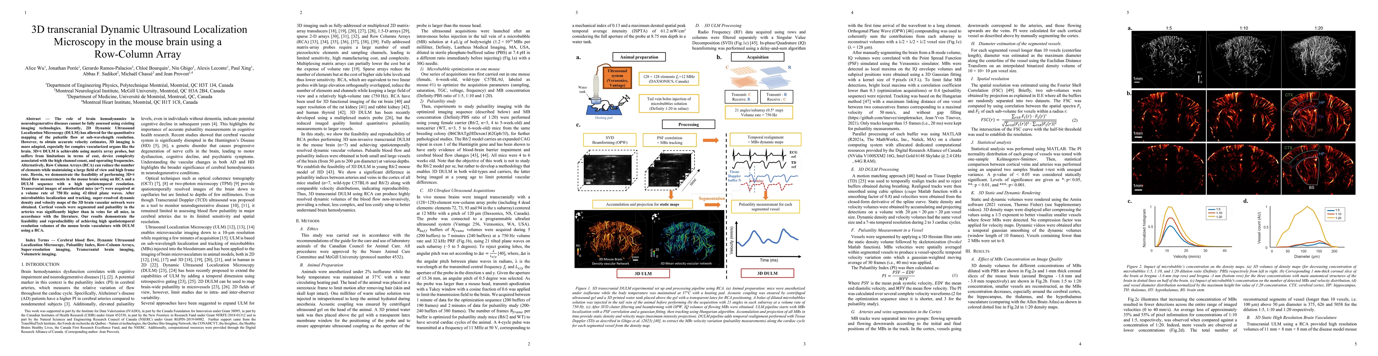 Thumbnail for 3D transcranial Dynamic Ultrasound Localization Microscopy in the mouse
  brain using a Row-Column Array