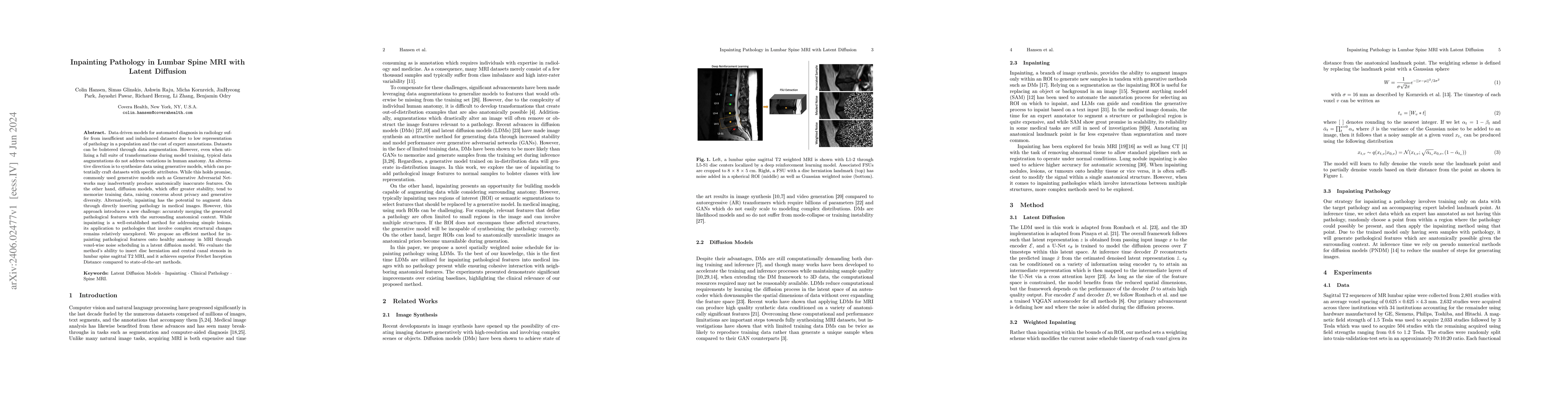 Thumbnail for Inpainting Pathology in Lumbar Spine MRI with Latent Diffusion
