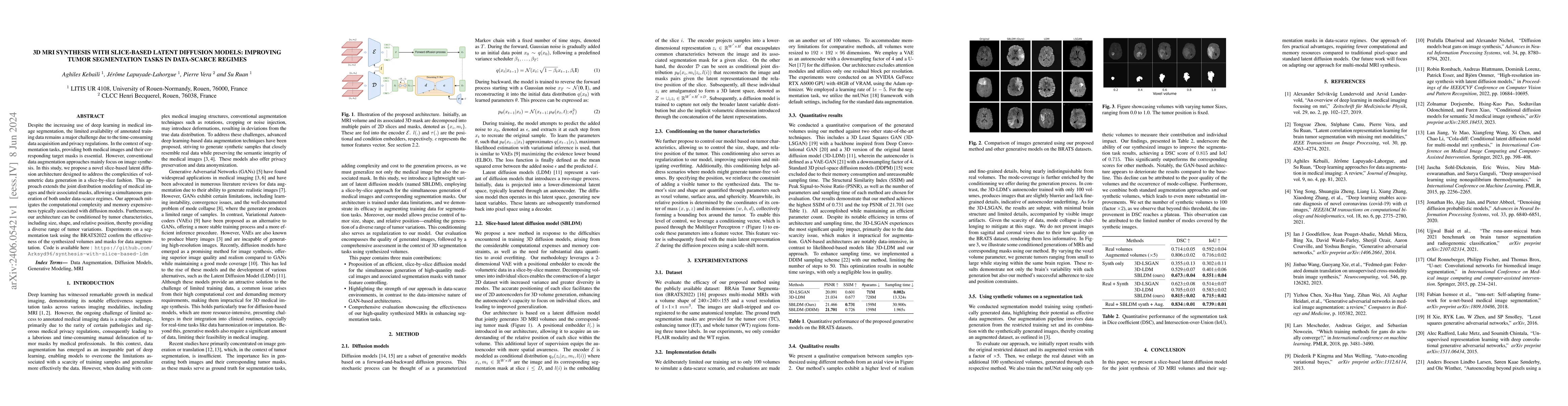Thumbnail for 3D MRI Synthesis with Slice-Based Latent Diffusion Models: Improving
  Tumor Segmentation Tasks in Data-Scarce Regimes