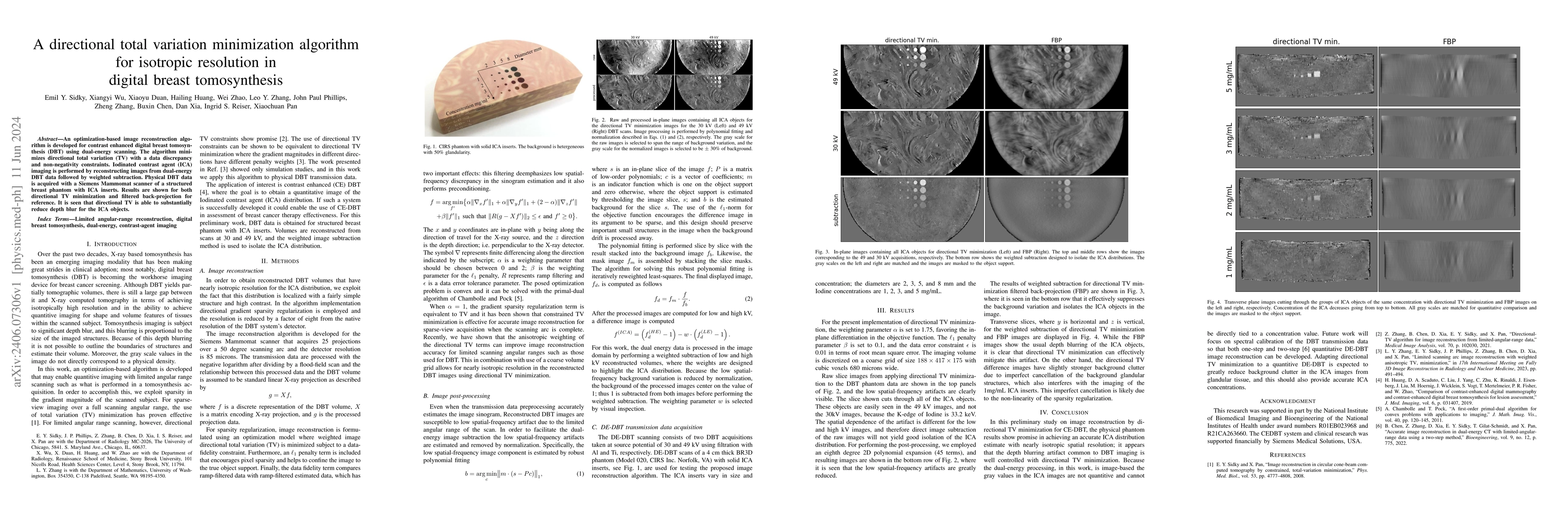 Thumbnail for A directional total variation minimization algorithm for isotropic
  resolution in digital breast tomosynthesis