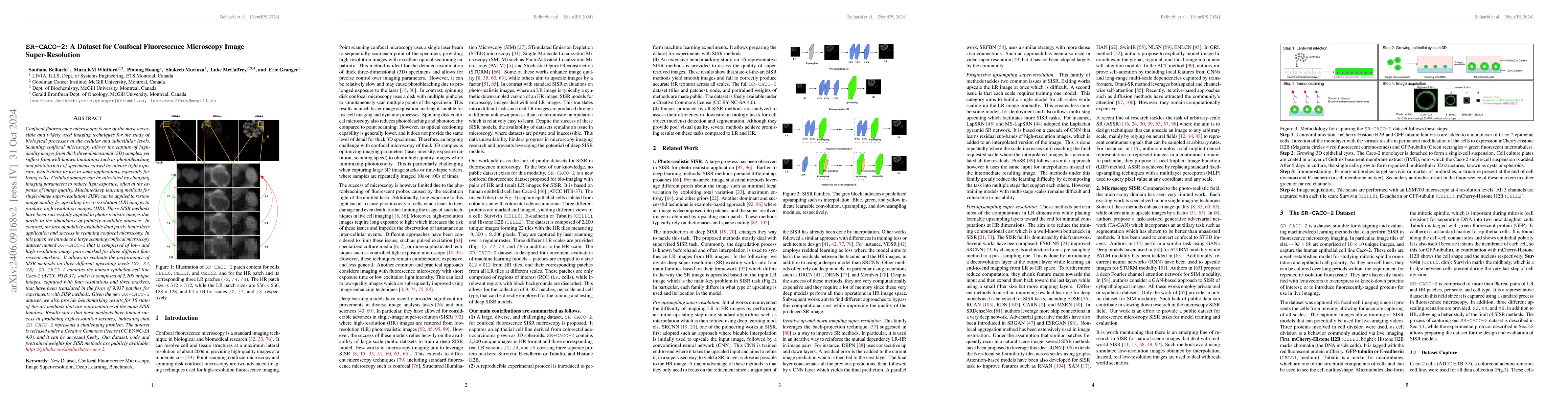 Thumbnail for SR-CACO-2: A Dataset for Confocal Fluorescence Microscopy Image
  Super-Resolution