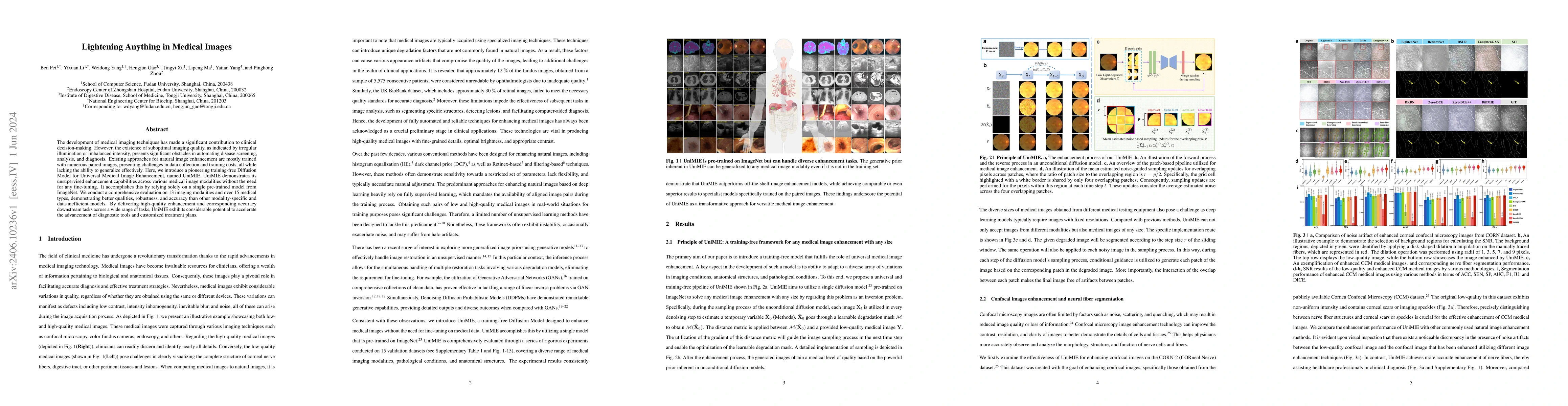 Thumbnail for Lightening Anything in Medical Images