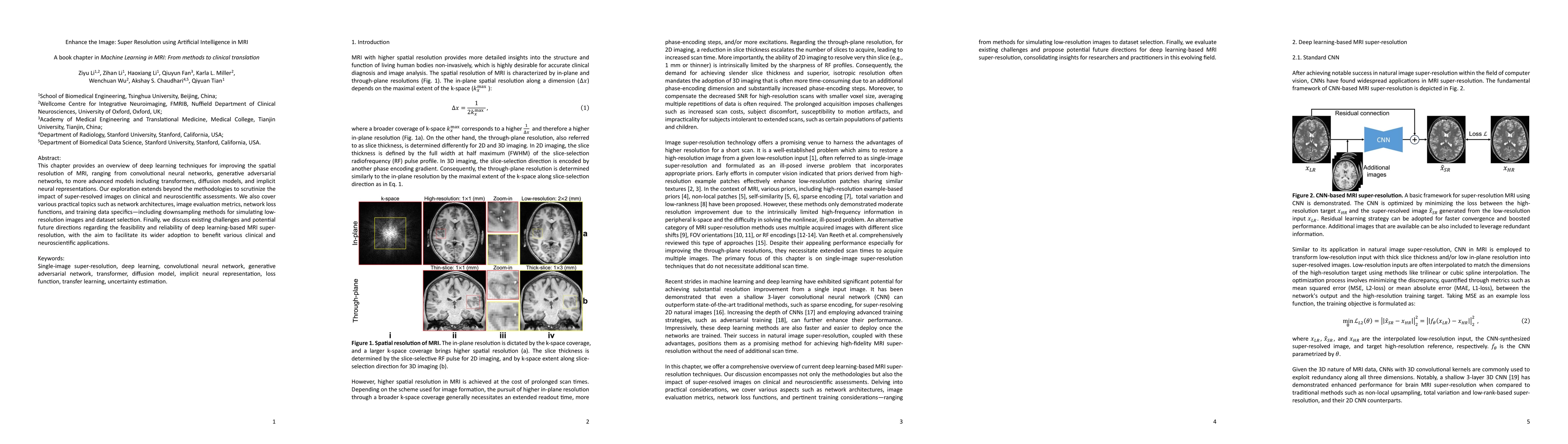 Thumbnail for Enhance the Image: Super Resolution using Artificial Intelligence in MRI