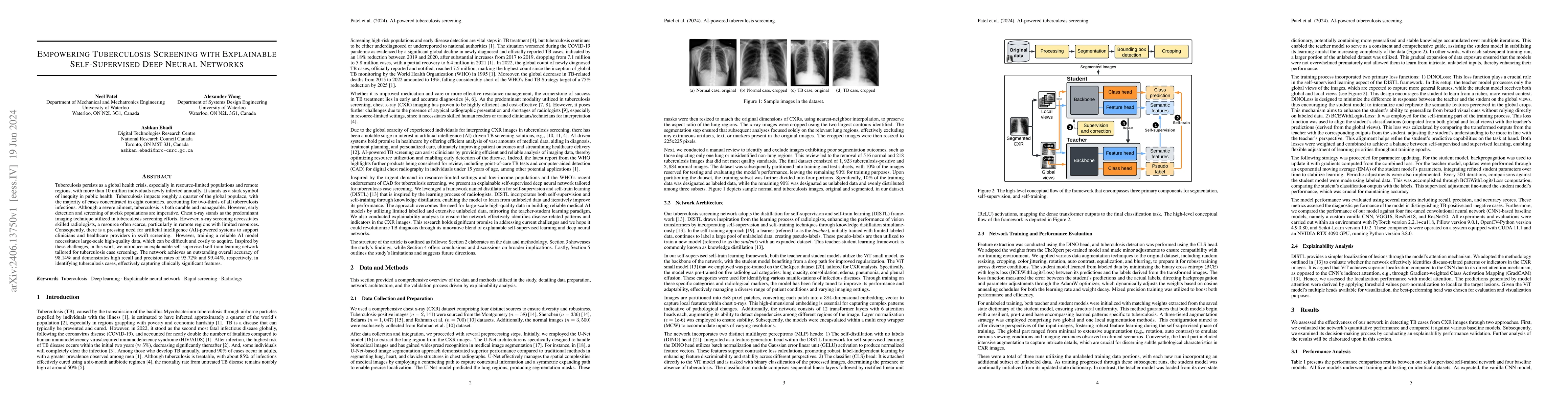 Thumbnail for Empowering Tuberculosis Screening with Explainable Self-Supervised Deep
  Neural Networks