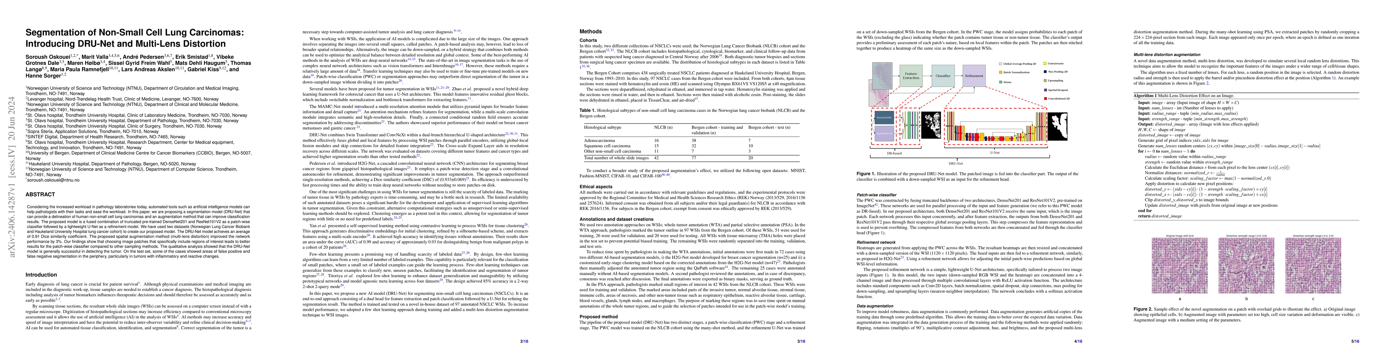 Thumbnail for Segmentation of Non-Small Cell Lung Carcinomas: Introducing DRU-Net and
  Multi-Lens Distortion