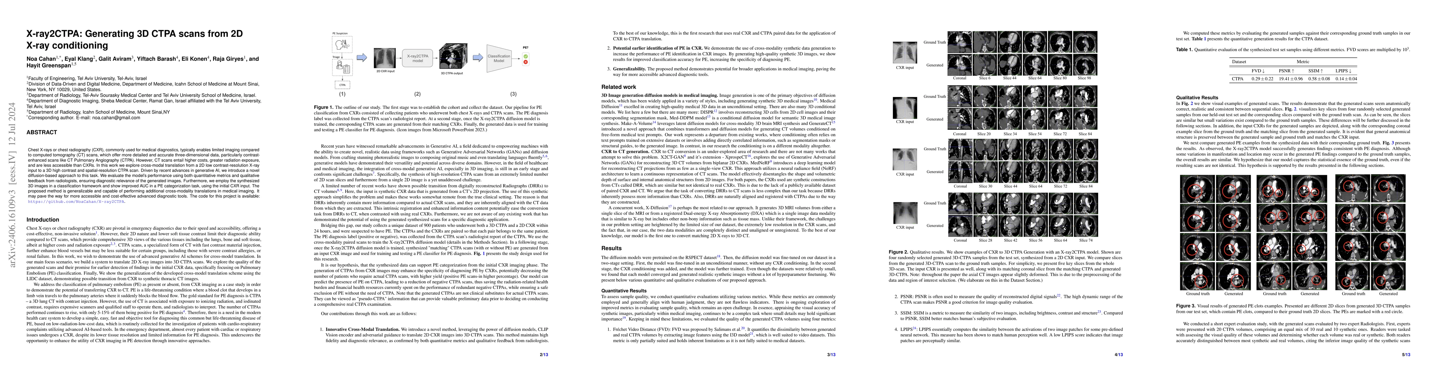 Thumbnail for X-ray2CTPA: Generating 3D CTPA scans from 2D X-ray conditioning
