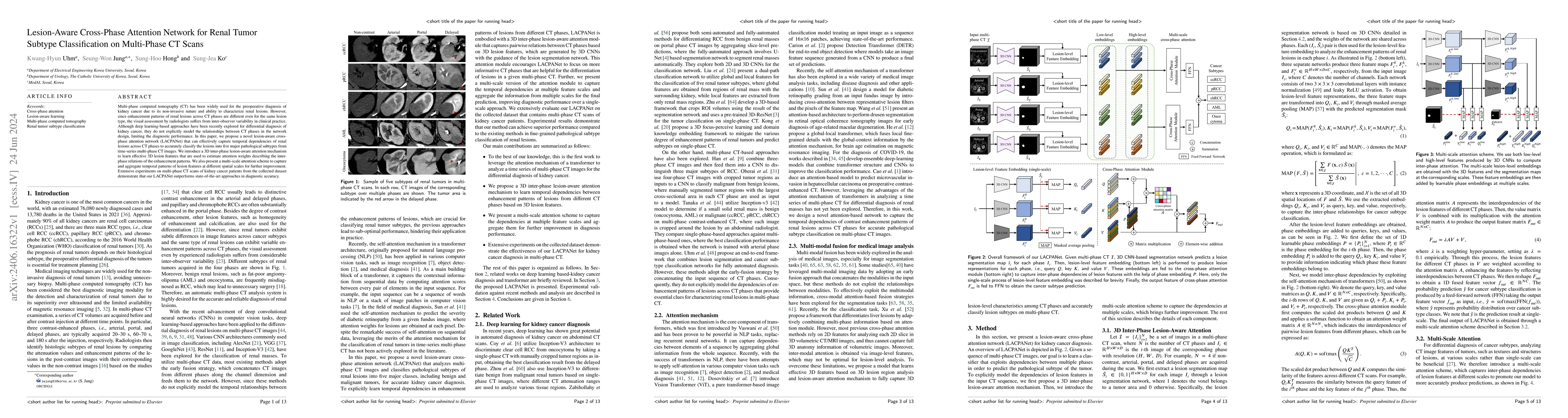 Thumbnail for Lesion-Aware Cross-Phase Attention Network for Renal Tumor Subtype
  Classification on Multi-Phase CT Scans