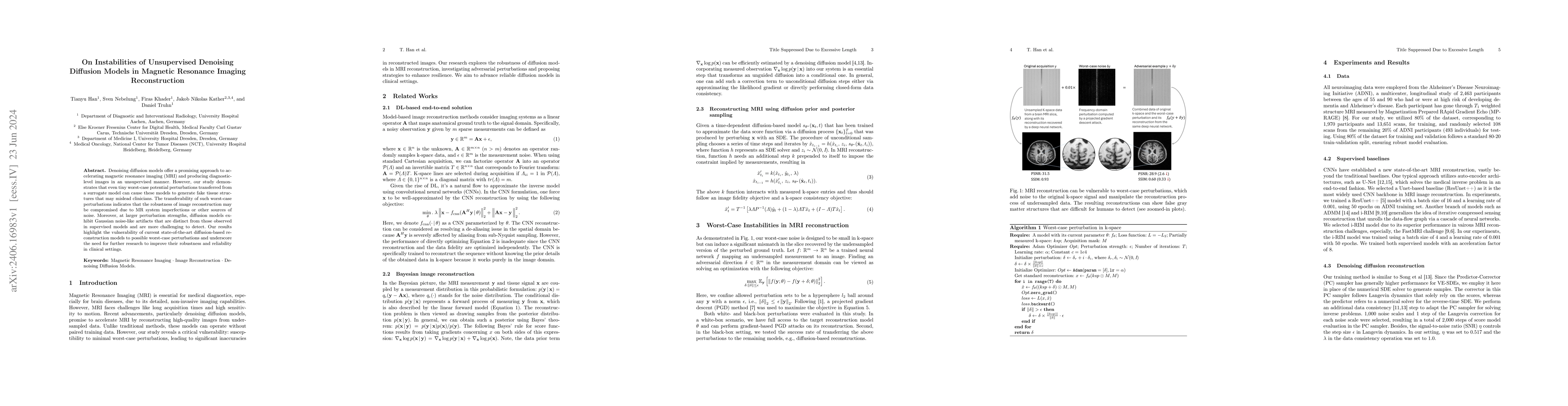 Thumbnail for On Instabilities of Unsupervised Denoising Diffusion Models in Magnetic
  Resonance Imaging Reconstruction