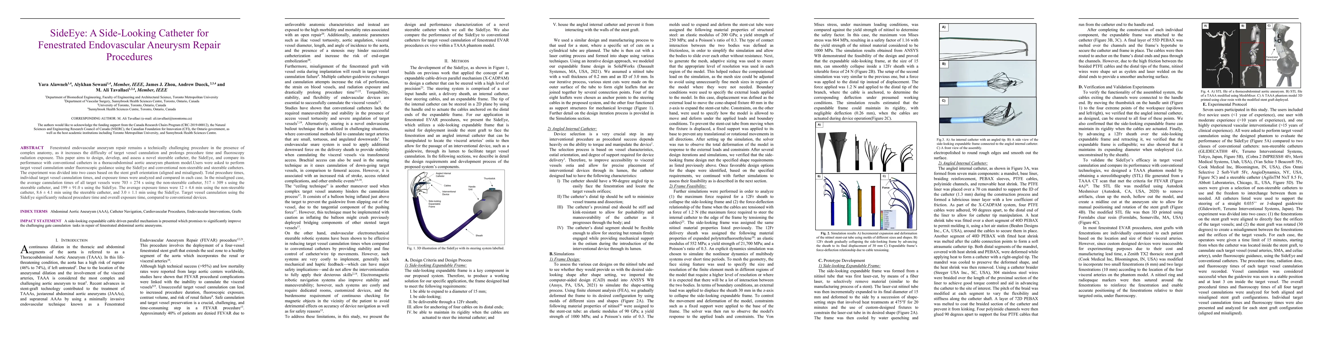 Thumbnail for SideEye: A Side-Looking Catheter for Fenestrated Endovascular Aneurysm
  Repair Procedures