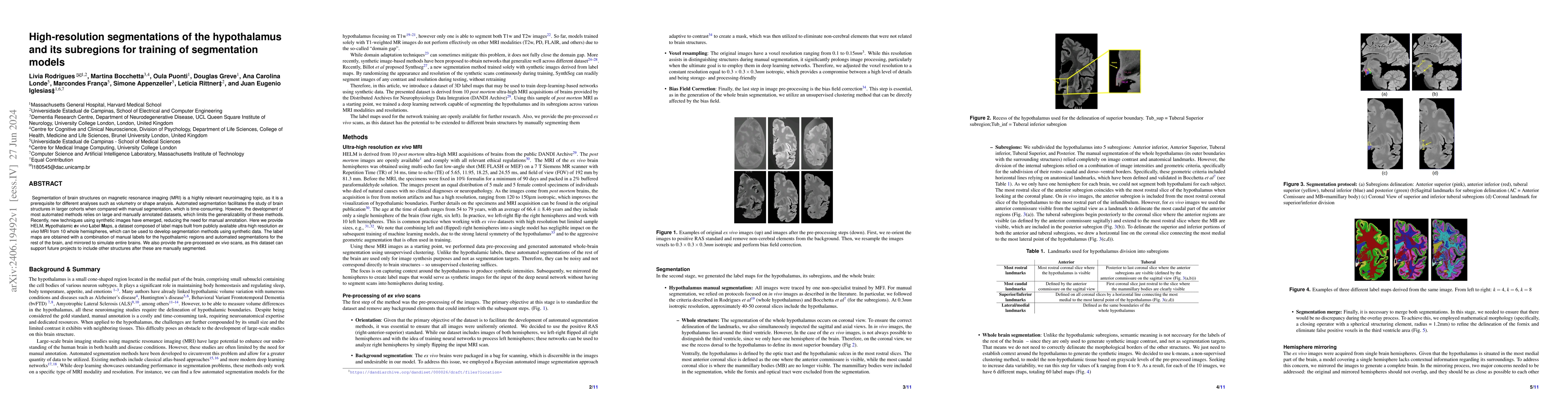Thumbnail for High-resolution segmentations of the hypothalamus and its subregions for
  training of segmentation models