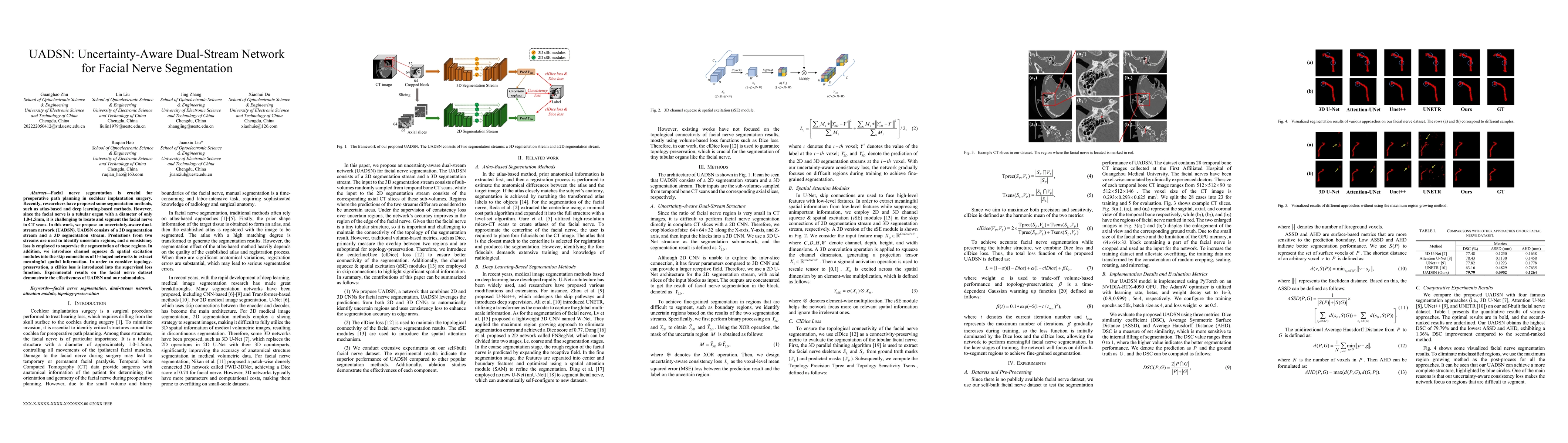 Thumbnail for UADSN: Uncertainty-Aware Dual-Stream Network for Facial Nerve
  Segmentation