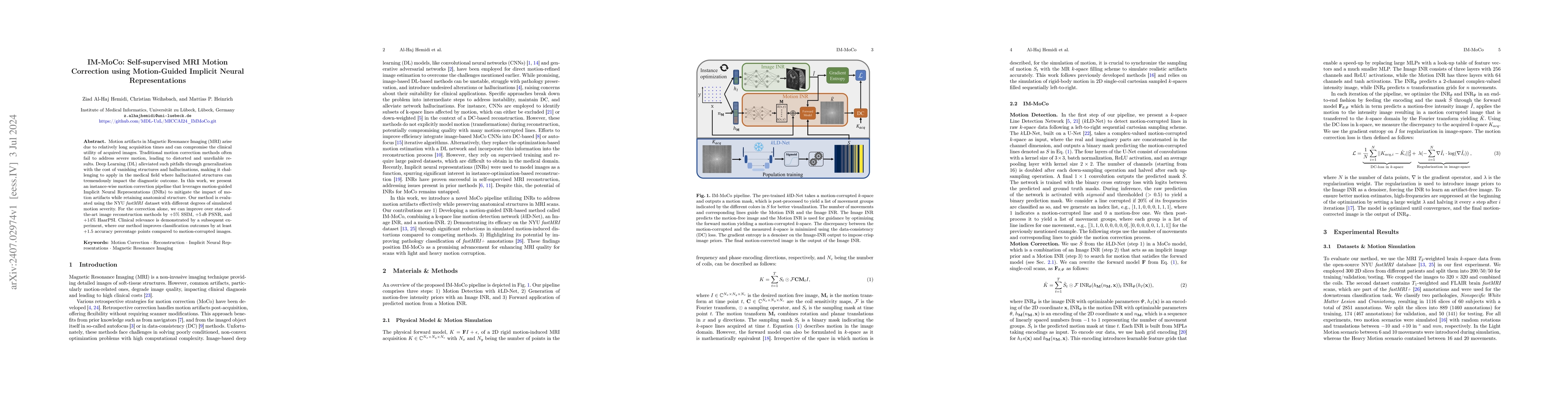 Thumbnail for IM-MoCo: Self-supervised MRI Motion Correction using Motion-Guided
  Implicit Neural Representations