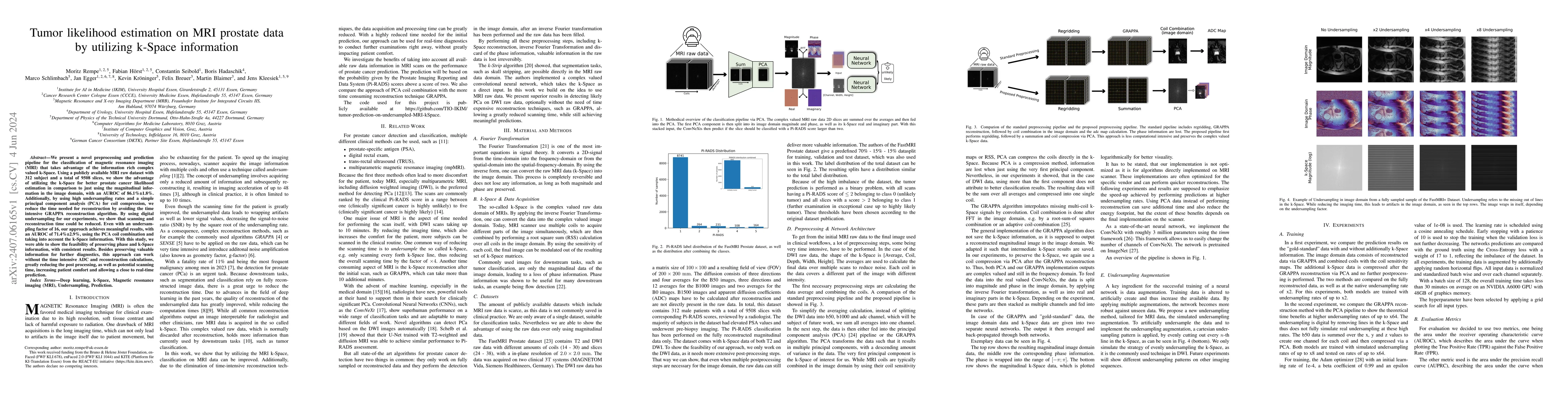 Thumbnail for Tumor likelihood estimation on MRI prostate data by utilizing k-Space
  information