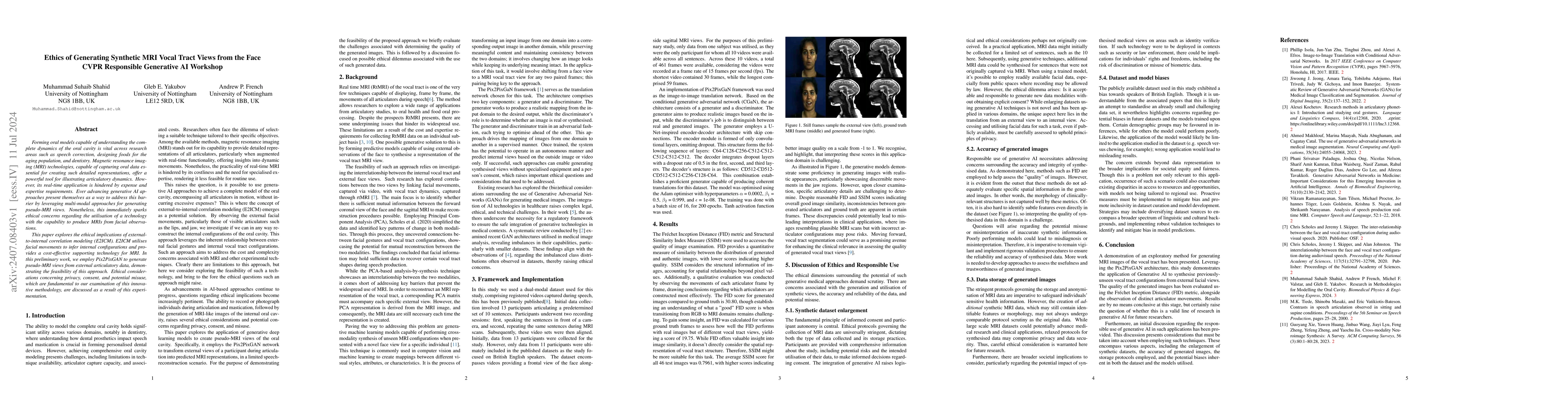 Thumbnail for Ethics of Generating Synthetic MRI Vocal Tract Views from the Face