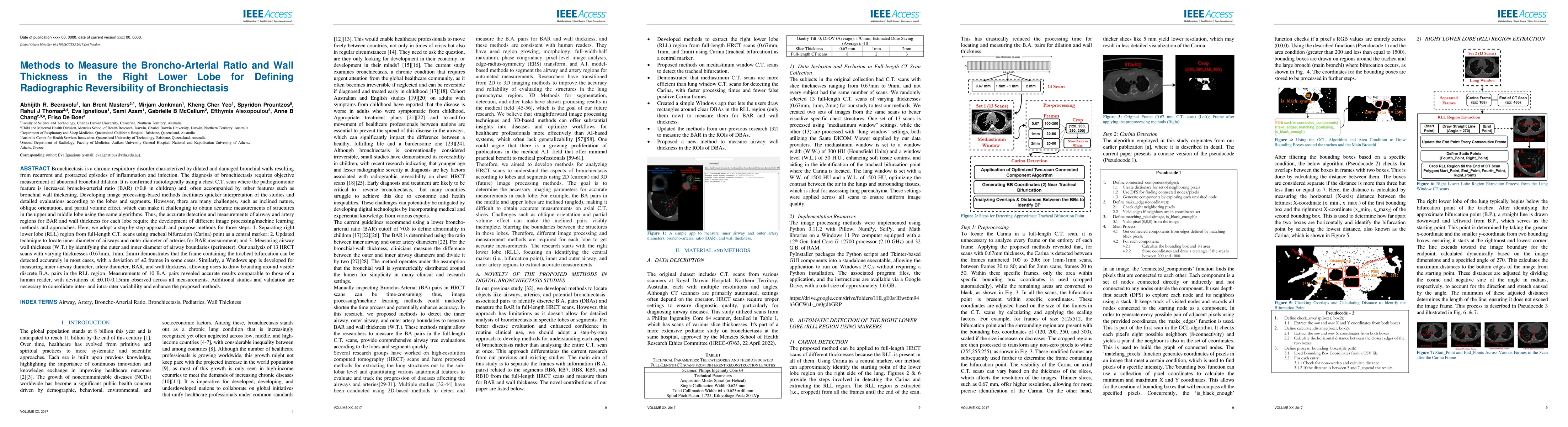 Thumbnail for Methods to Measure the Broncho-Arterial Ratio and Wall Thickness in the
  Right Lower Lobe for Defining Radiographic Reversibility of Bronchiectasis