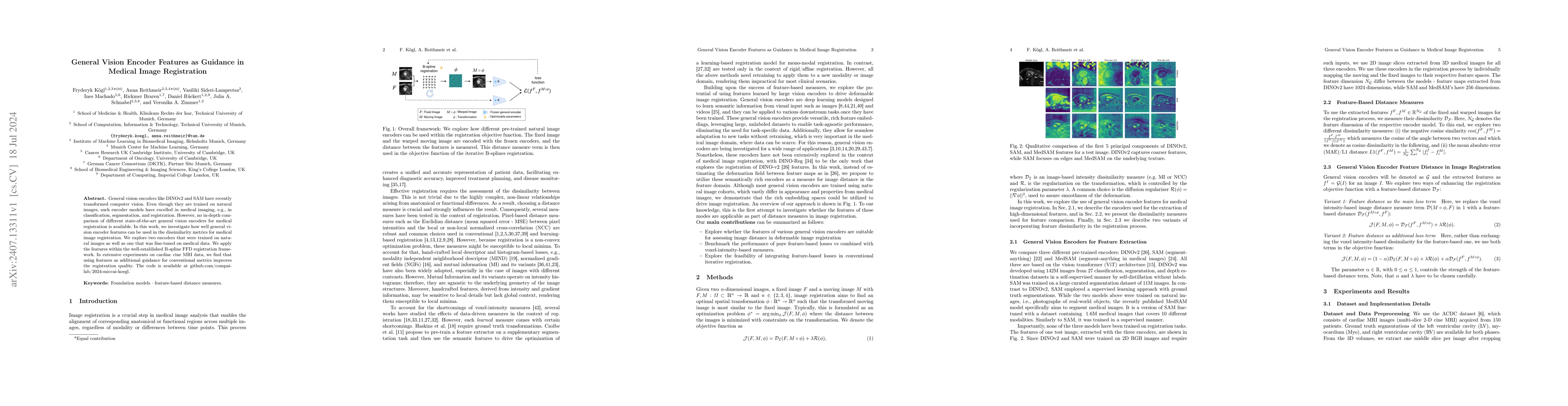 Thumbnail for General Vision Encoder Features as Guidance in Medical Image
  Registration