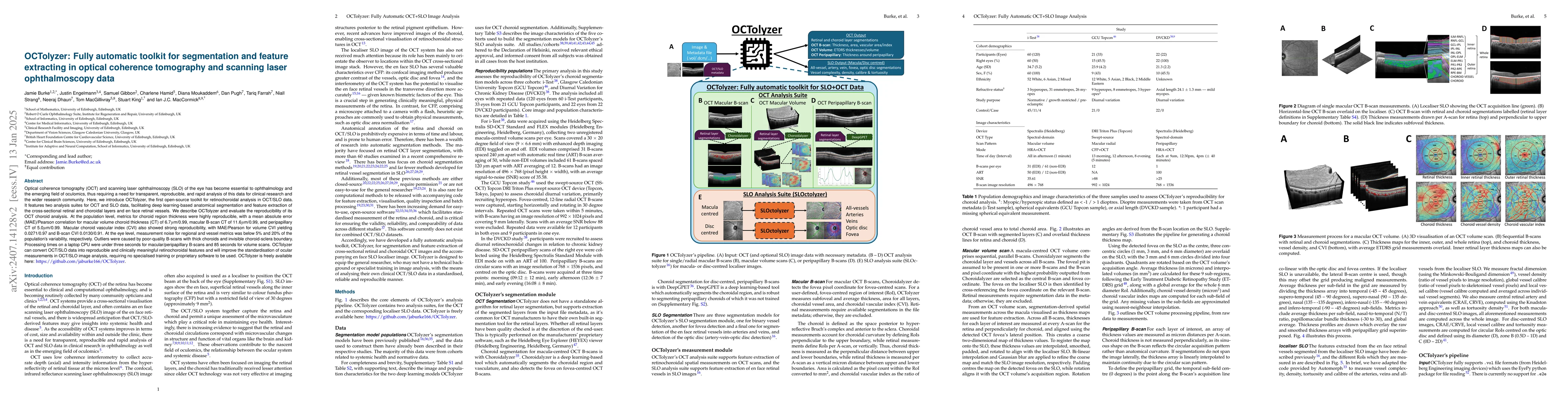 Thumbnail for OCTolyzer: Fully automatic analysis toolkit for segmentation and feature
  extracting in optical coherence tomography (OCT) and scanning laser
  ophthalmoscopy (SLO) data
