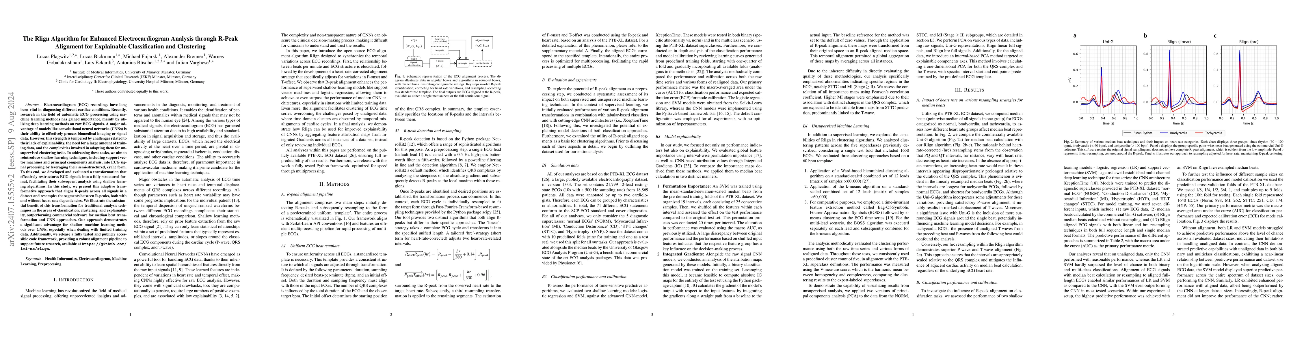 Thumbnail for The Rlign Algorithm for Enhanced Electrocardiogram Analysis through
  R-Peak Alignment for Explainable Classification and Clustering