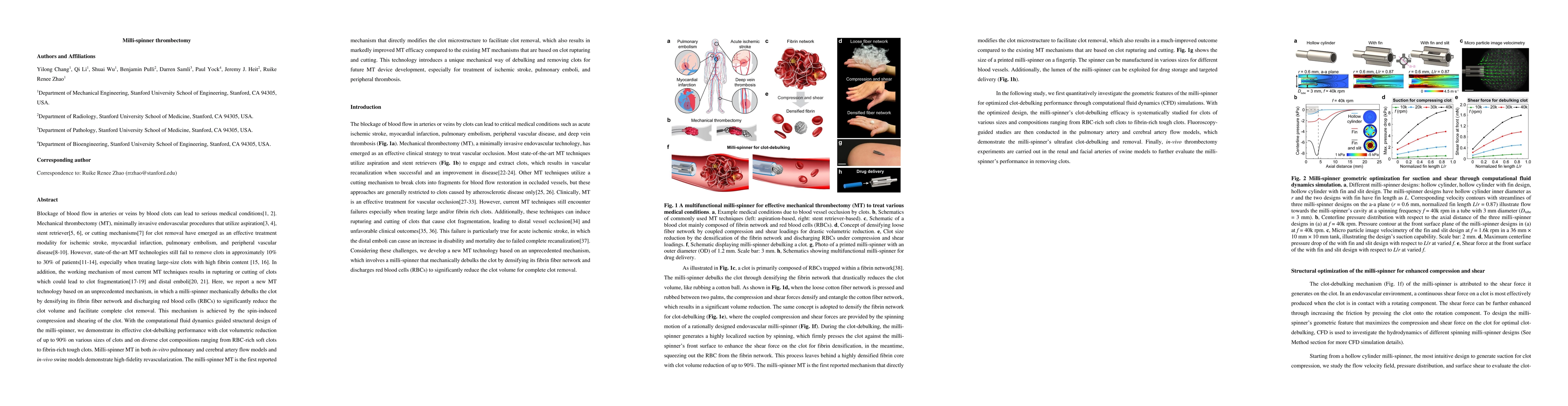 Thumbnail for Milli-spinner thrombectomy