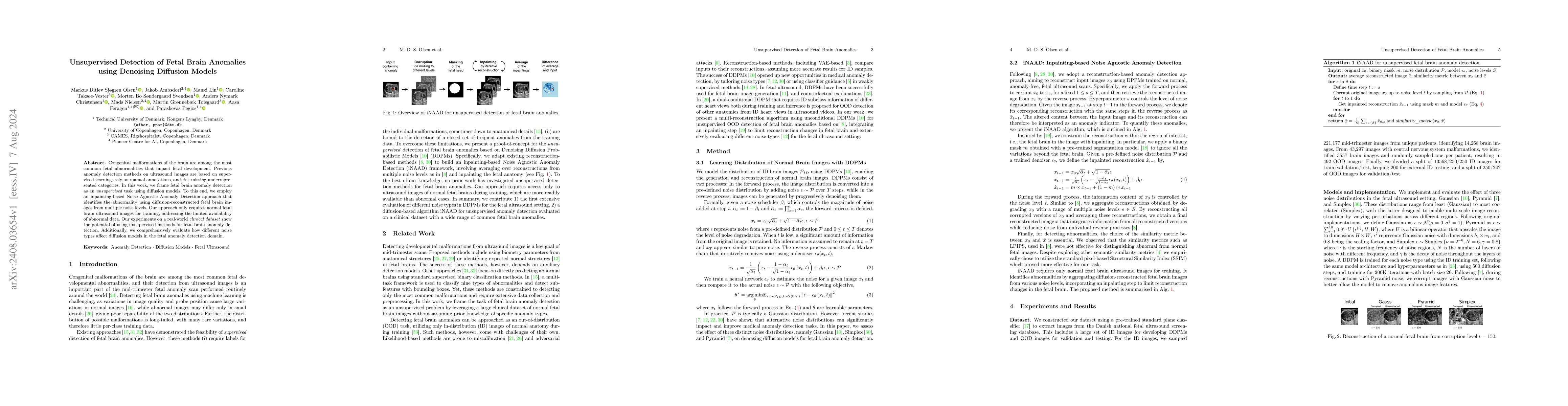 Thumbnail for Unsupervised Detection of Fetal Brain Anomalies using Denoising
  Diffusion Models