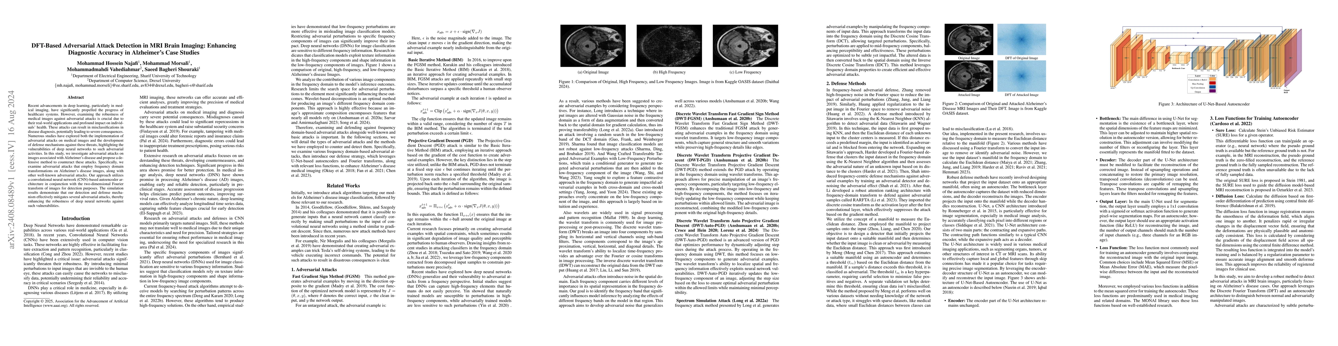 Thumbnail for DFT-Based Adversarial Attack Detection in MRI Brain Imaging: Enhancing
  Diagnostic Accuracy in Alzheimer's Case Studies