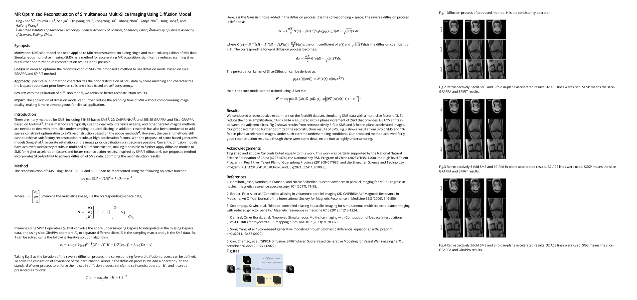 Thumbnail for MR Optimized Reconstruction of Simultaneous Multi-Slice Imaging Using
  Diffusion Model