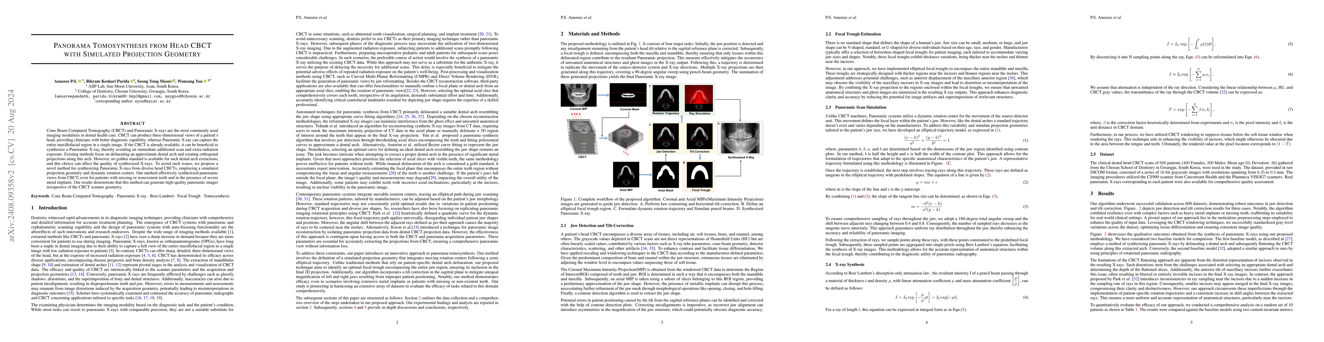 Thumbnail for Panorama Tomosynthesis from Head CBCT with Simulated Projection Geometry
