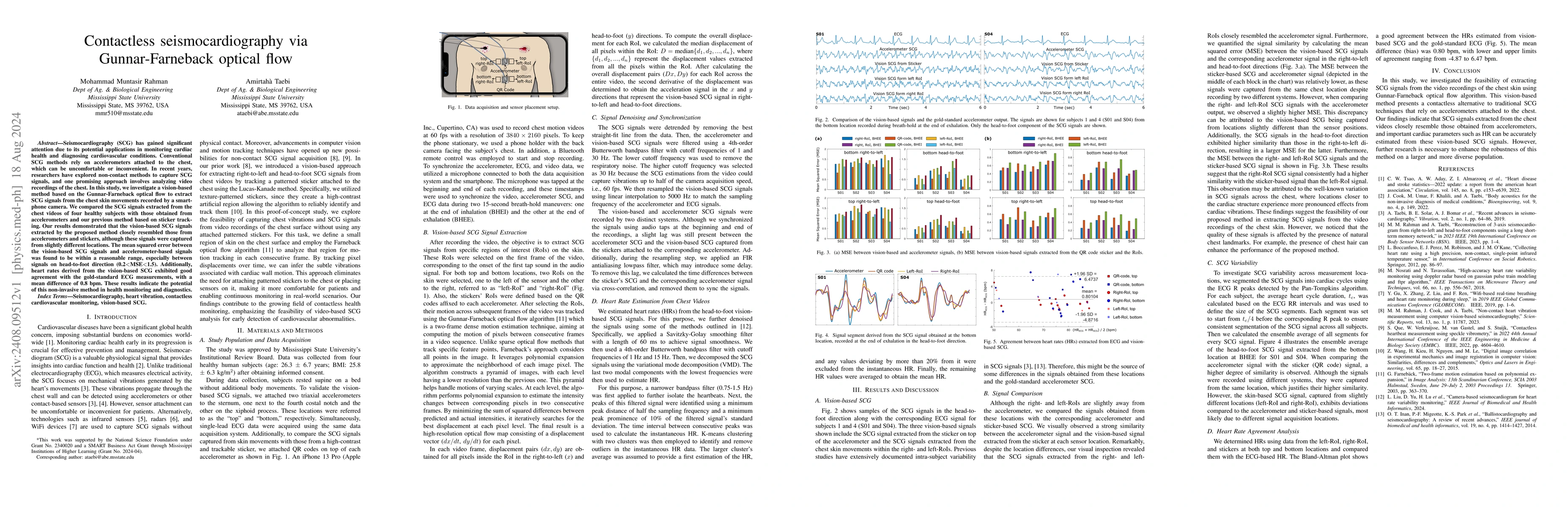 Thumbnail for Contactless seismocardiography via Gunnar-Farneback optical flow
