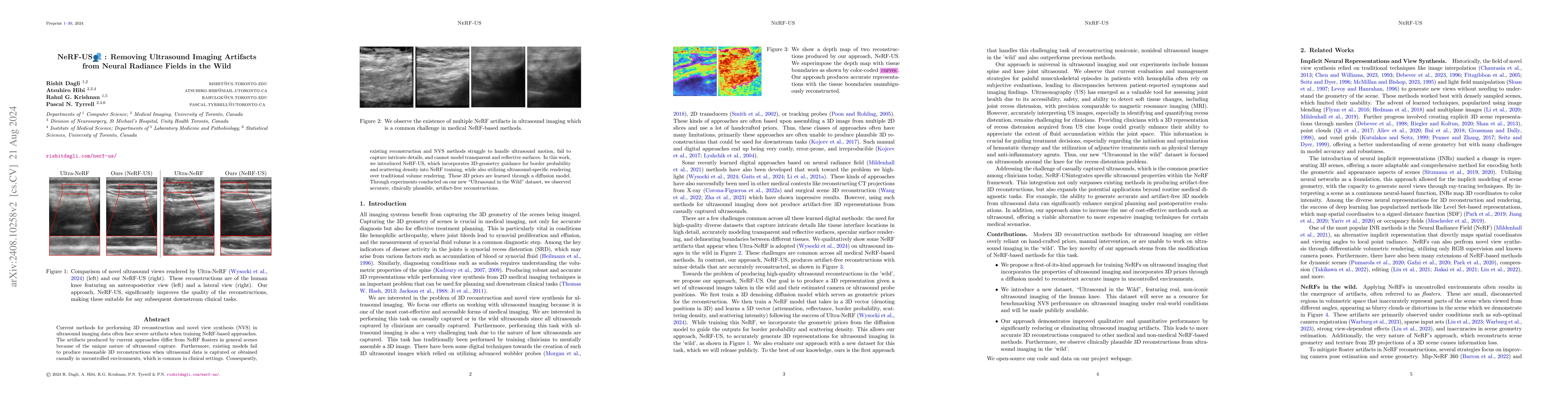 Thumbnail for NeRF-US: Removing Ultrasound Imaging Artifacts from Neural Radiance
  Fields in the Wild