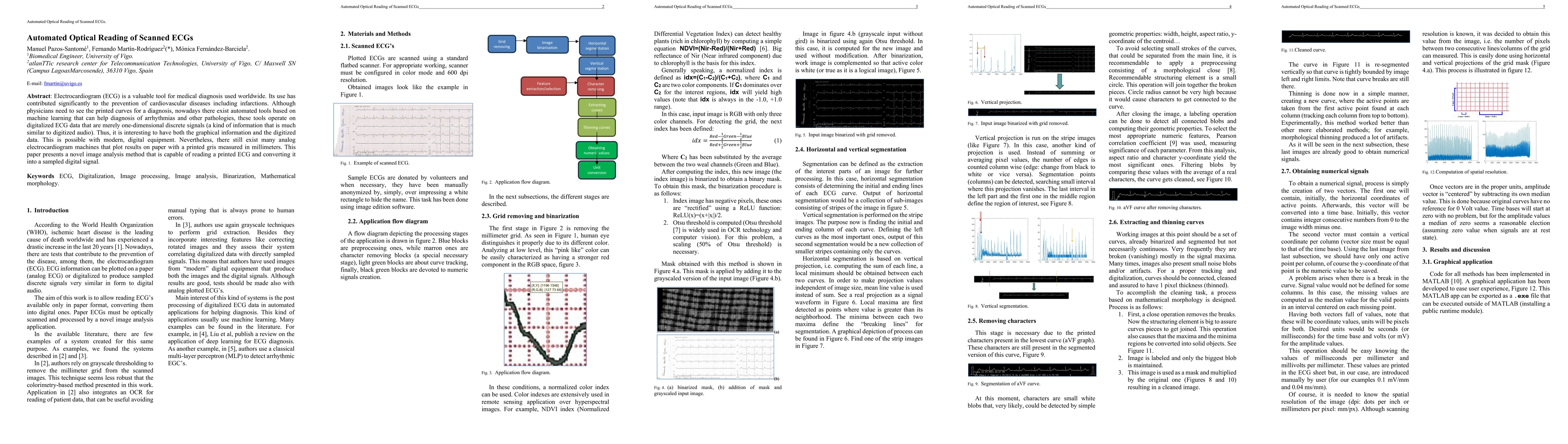 Thumbnail for Automated Optical Reading of Scanned ECGs
