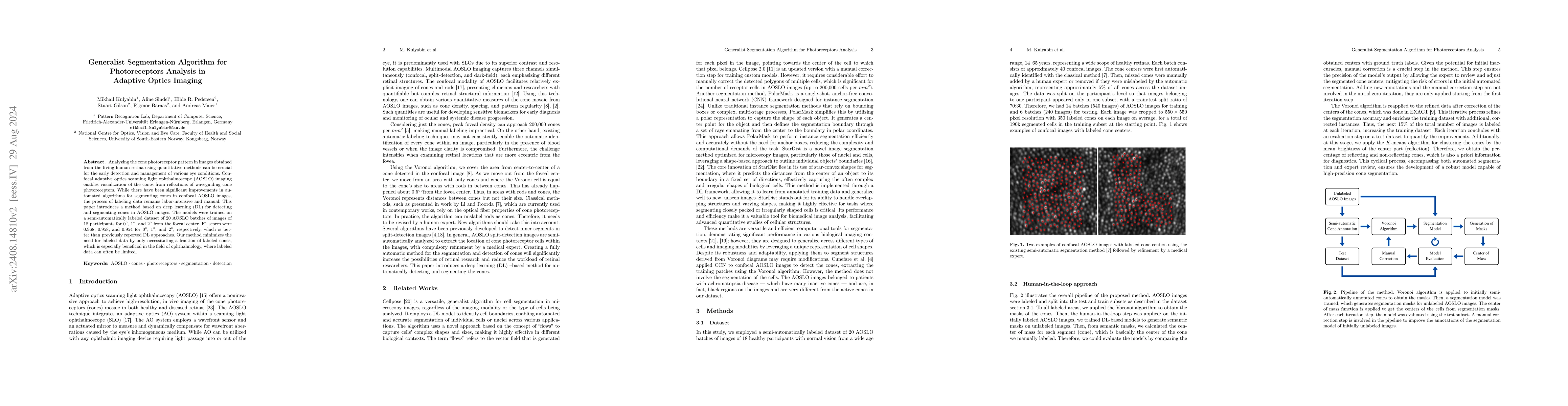 Thumbnail for Generalist Segmentation Algorithm for Photoreceptors Analysis in
  Adaptive Optics Imaging