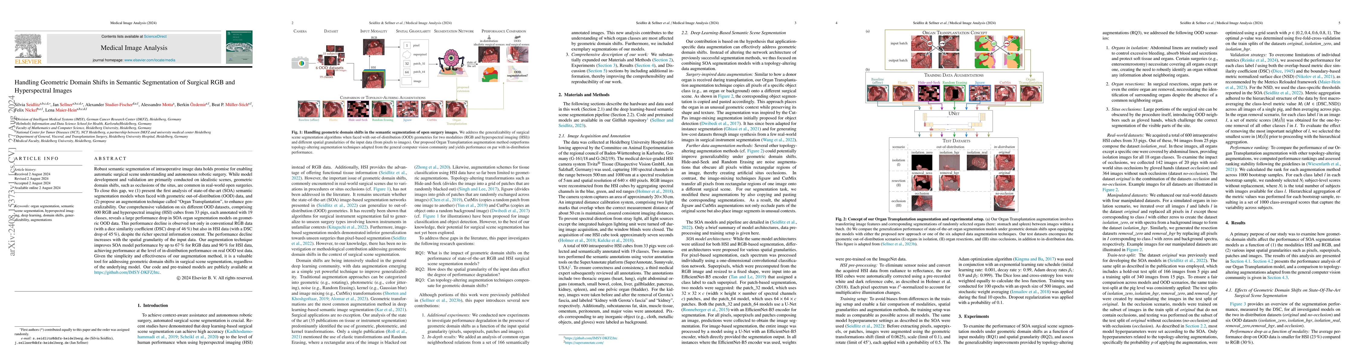 Thumbnail for Handling Geometric Domain Shifts in Semantic Segmentation of Surgical
  RGB and Hyperspectral Images