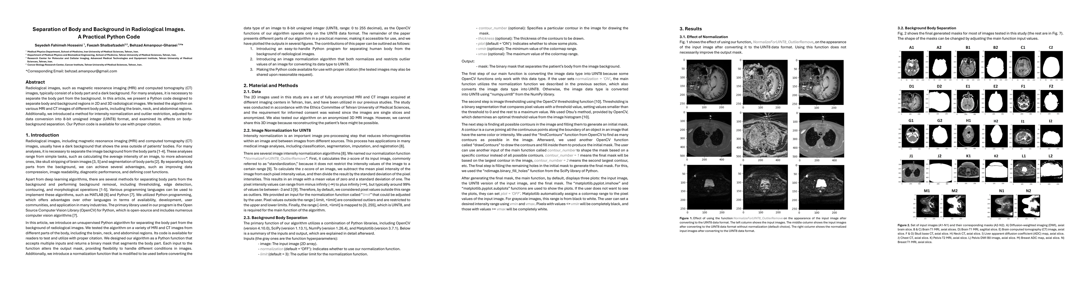 Thumbnail for Separation of Body and Background in Radiological Images. A Practical
  Python Code