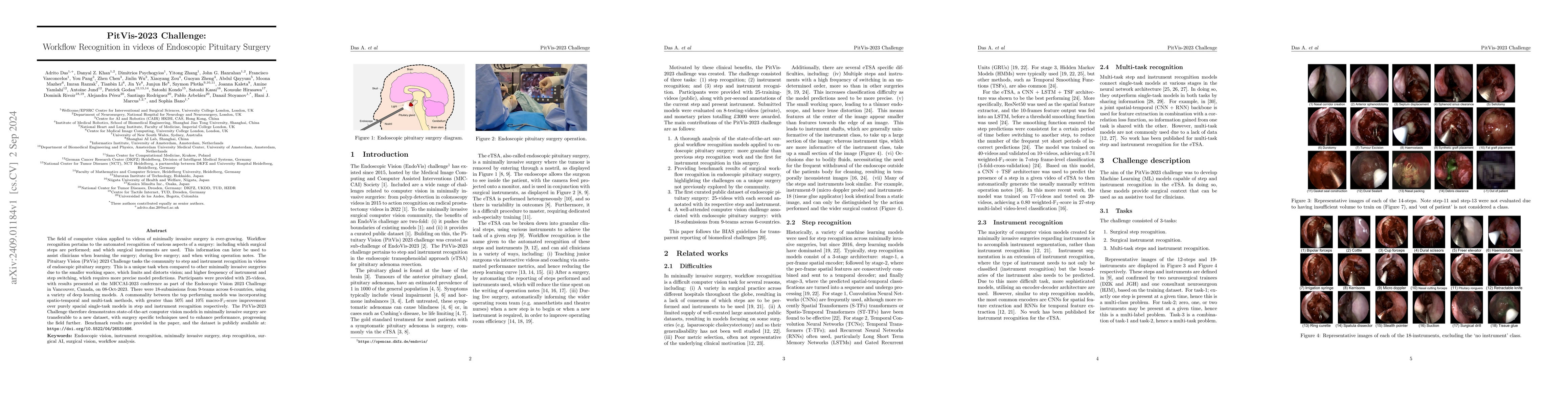 Thumbnail for PitVis-2023 Challenge: Workflow Recognition in videos of Endoscopic
  Pituitary Surgery