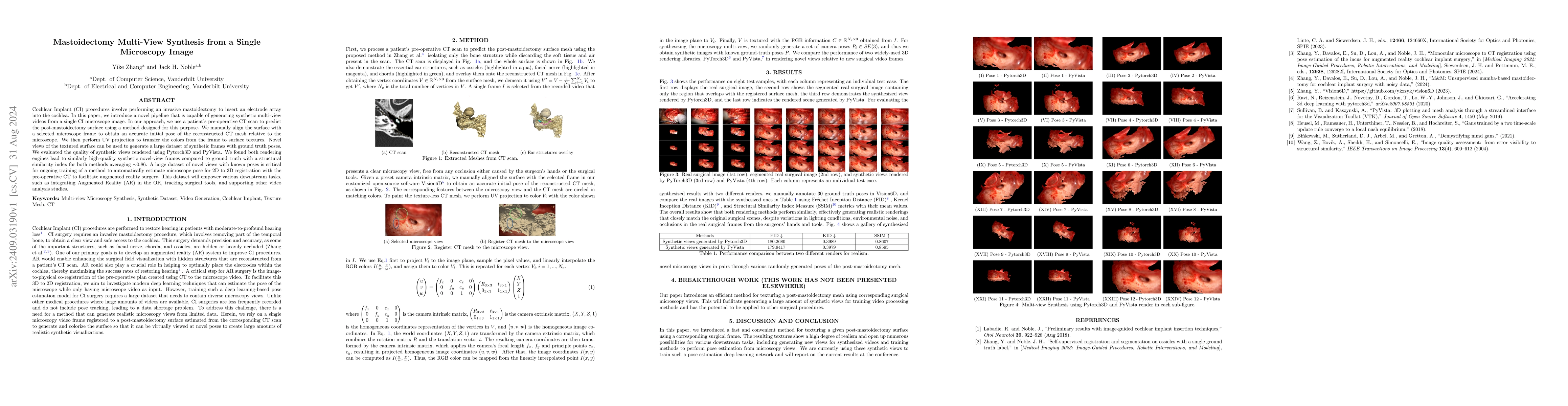 Thumbnail for Mastoidectomy Multi-View Synthesis from a Single Microscopy Image