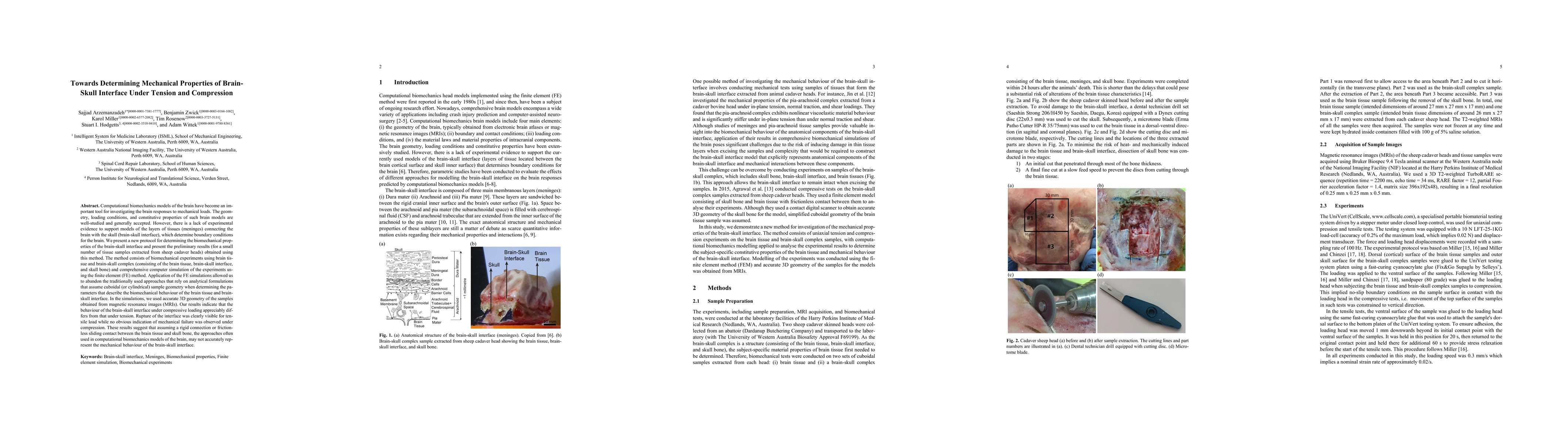 Thumbnail for Towards Determining Mechanical Properties of Brain-Skull Interface Under
  Tension and Compression