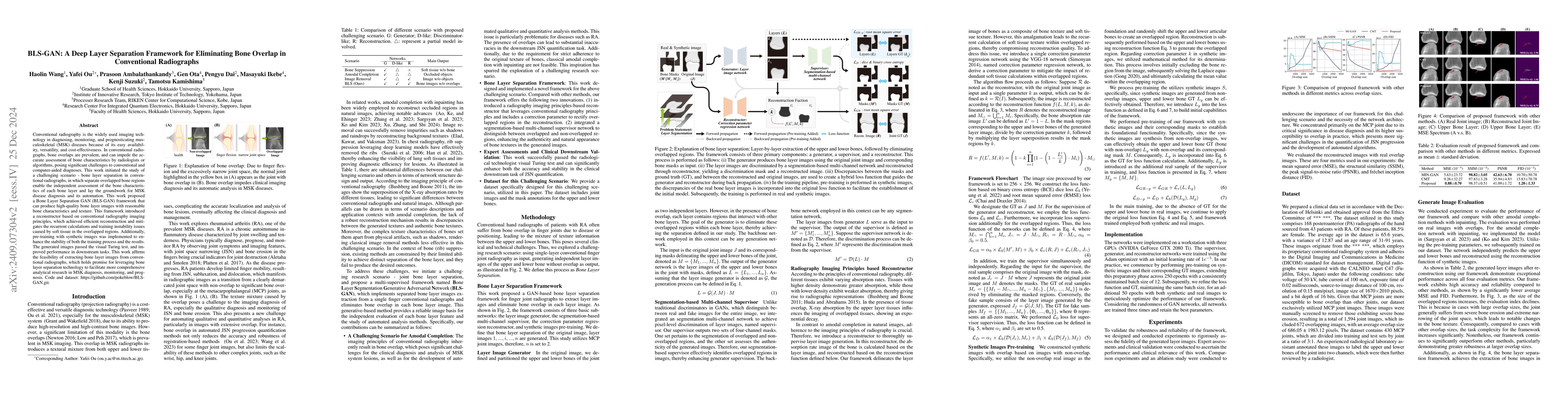 Thumbnail for BLS-GAN: A Deep Layer Separation Framework for Eliminating Bone Overlap
  in Conventional Radiographs