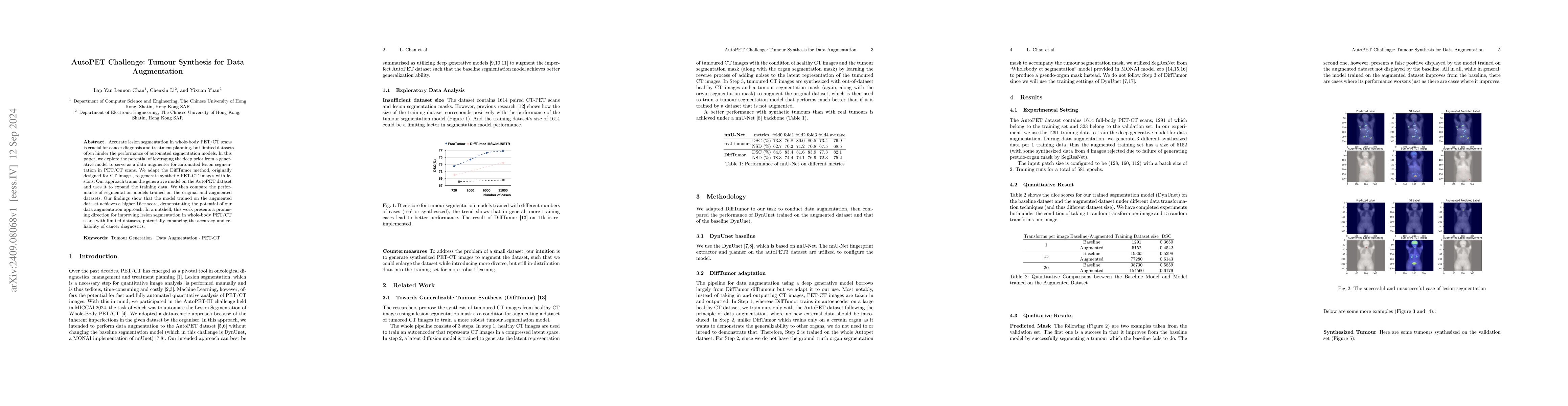 Thumbnail for AutoPET Challenge: Tumour Synthesis for Data Augmentation