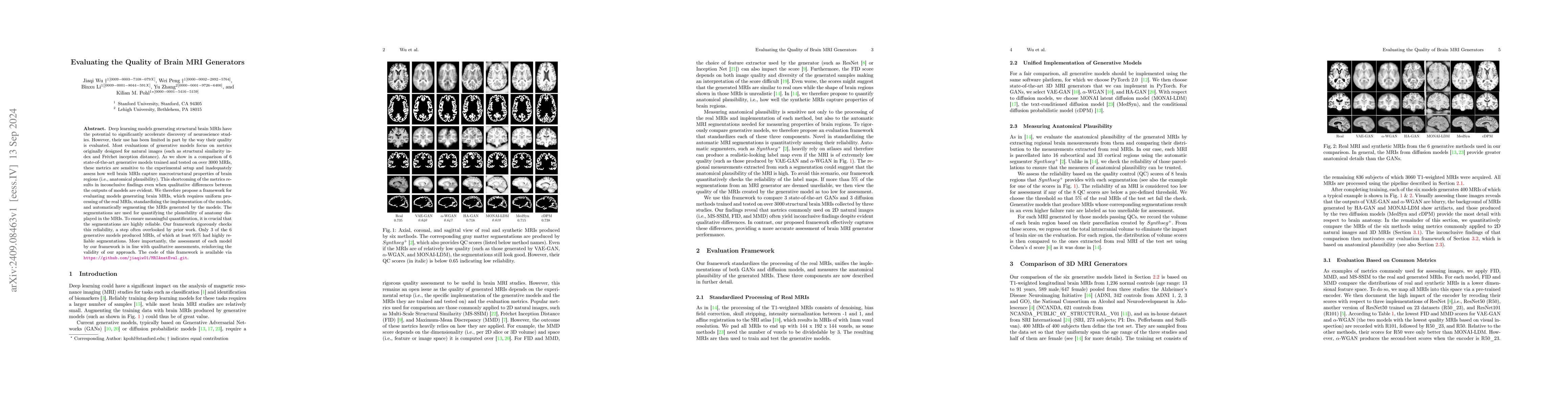 Thumbnail for Evaluating the Quality of Brain MRI Generators