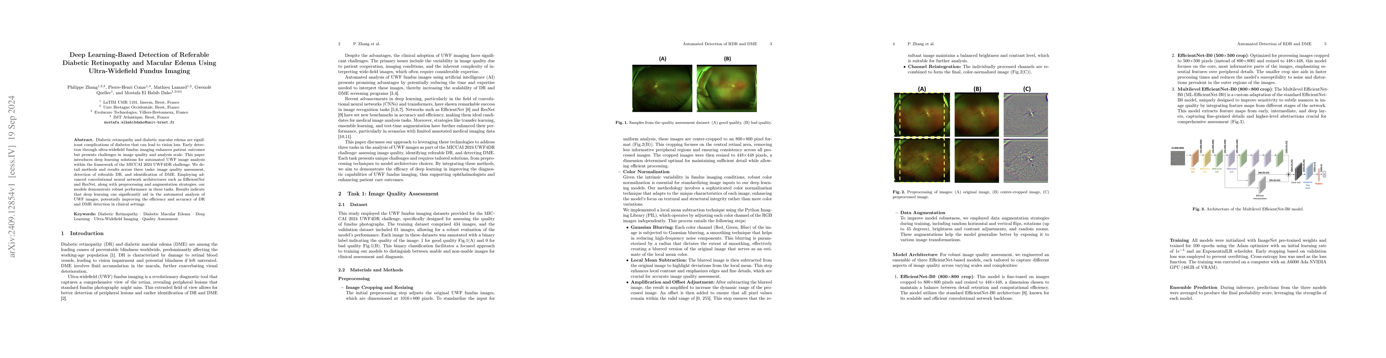 Thumbnail for Deep Learning-Based Detection of Referable Diabetic Retinopathy and
  Macular Edema Using Ultra-Widefield Fundus Imaging