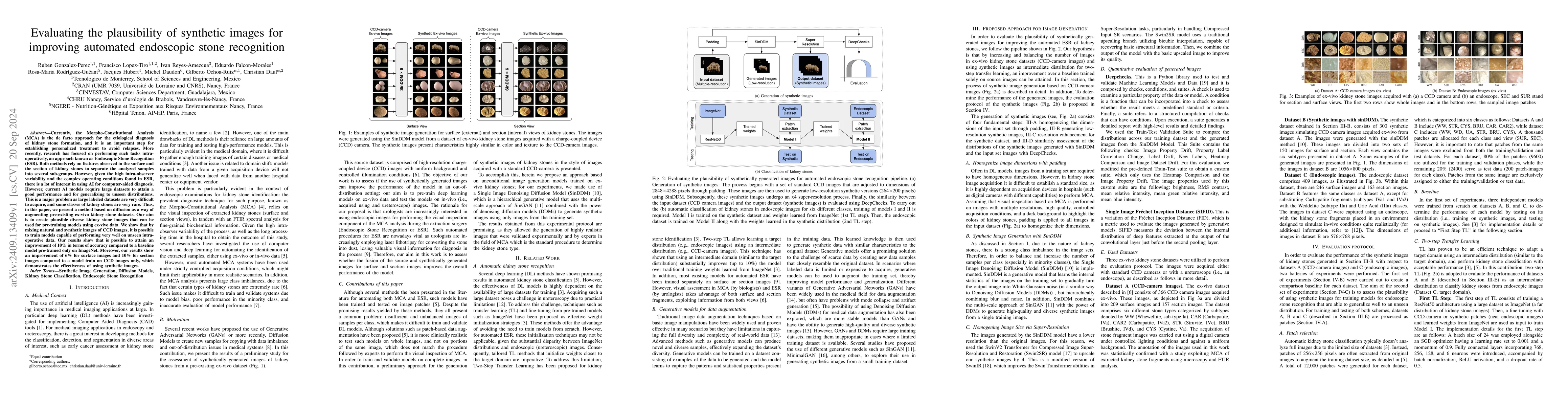 Thumbnail for Evaluating the plausibility of synthetic images for improving automated
  endoscopic stone recognition