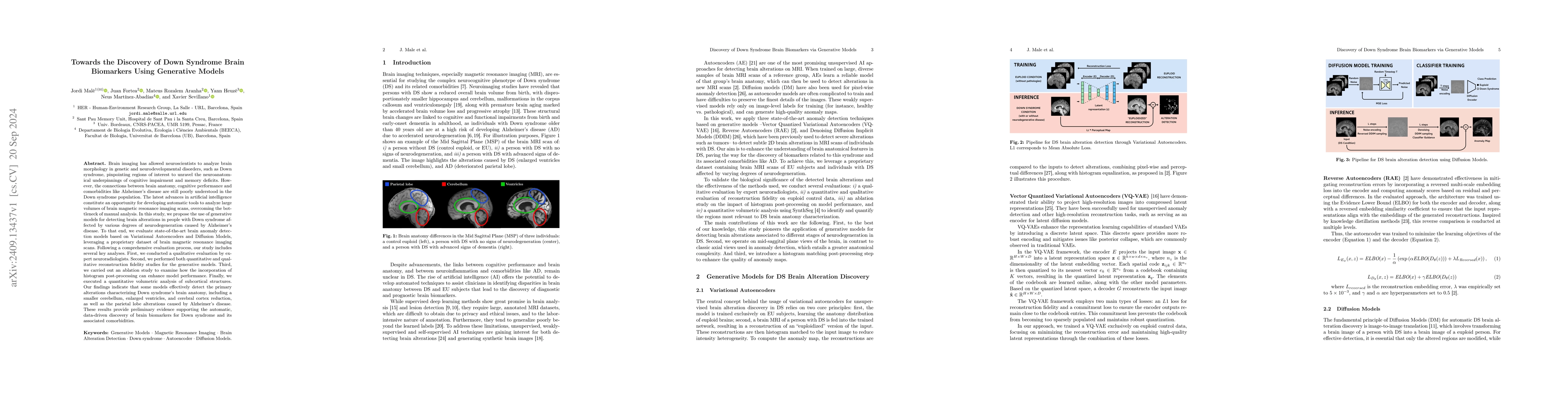 Thumbnail for Towards the Discovery of Down Syndrome Brain Biomarkers Using Generative
  Models