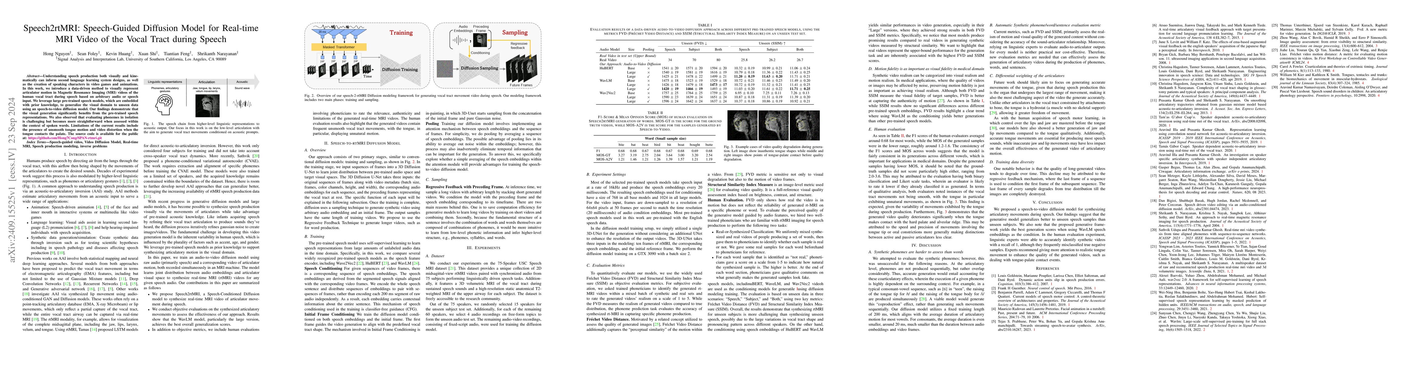 Thumbnail for Speech2rtMRI: Speech-Guided Diffusion Model for Real-time MRI Video of
  the Vocal Tract during Speech