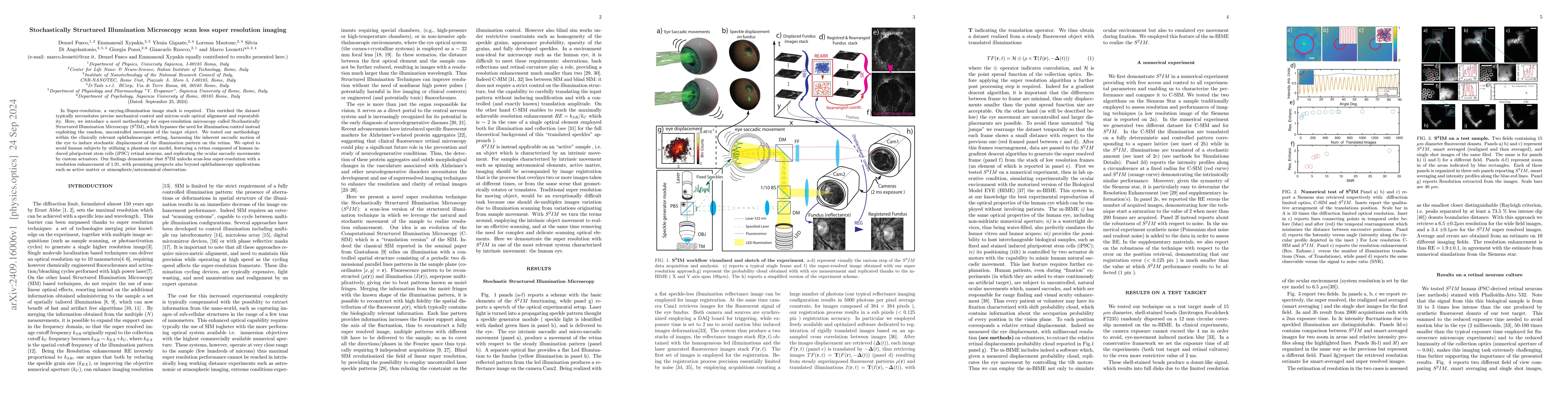 Thumbnail for Stochastically Structured Illumination Microscopy scan less super
  resolution imaging