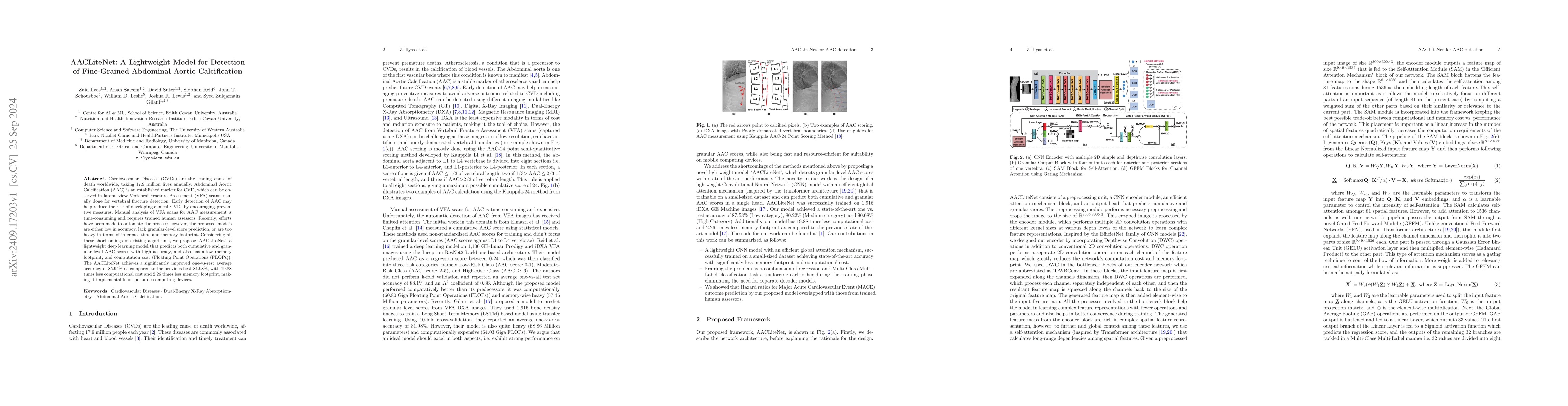 Thumbnail for AACLiteNet: A Lightweight Model for Detection of Fine-Grained Abdominal
  Aortic Calcification