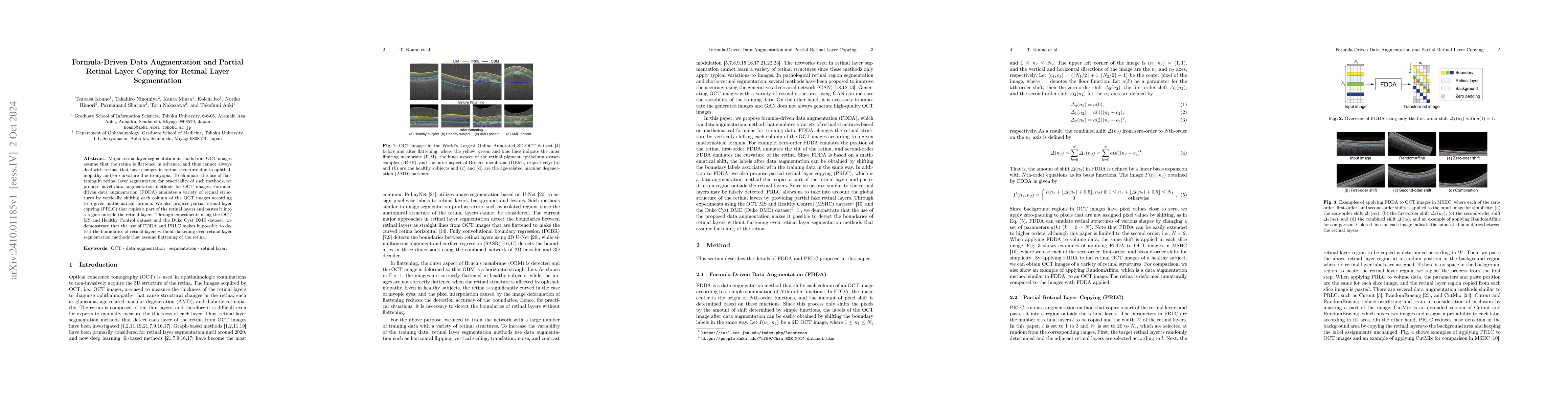 Thumbnail for Formula-Driven Data Augmentation and Partial Retinal Layer Copying for
  Retinal Layer Segmentation