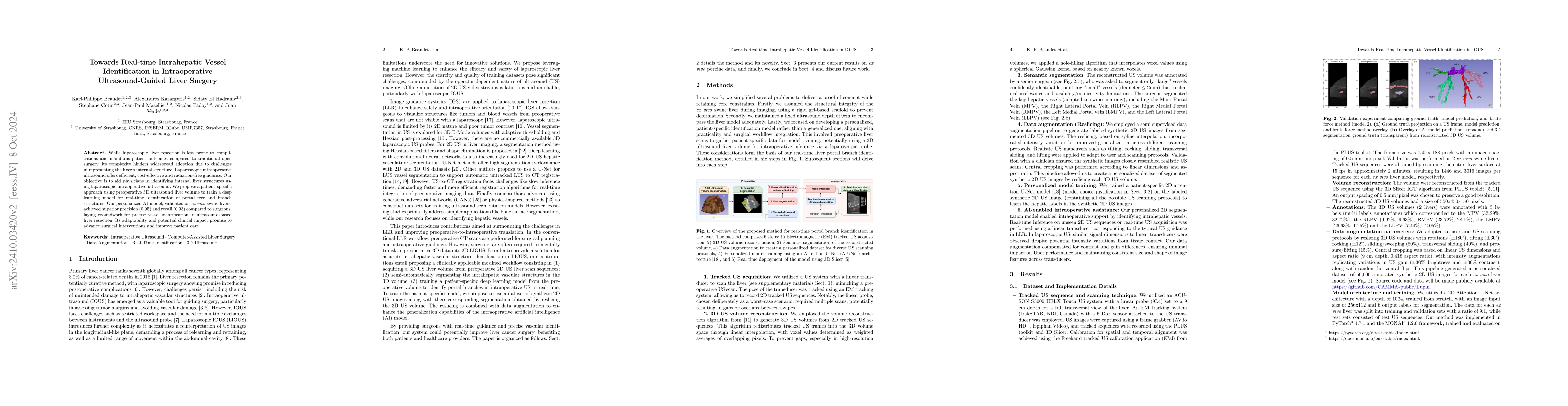 Thumbnail for Towards Real-time Intrahepatic Vessel Identification in Intraoperative
  Ultrasound-Guided Liver Surgery