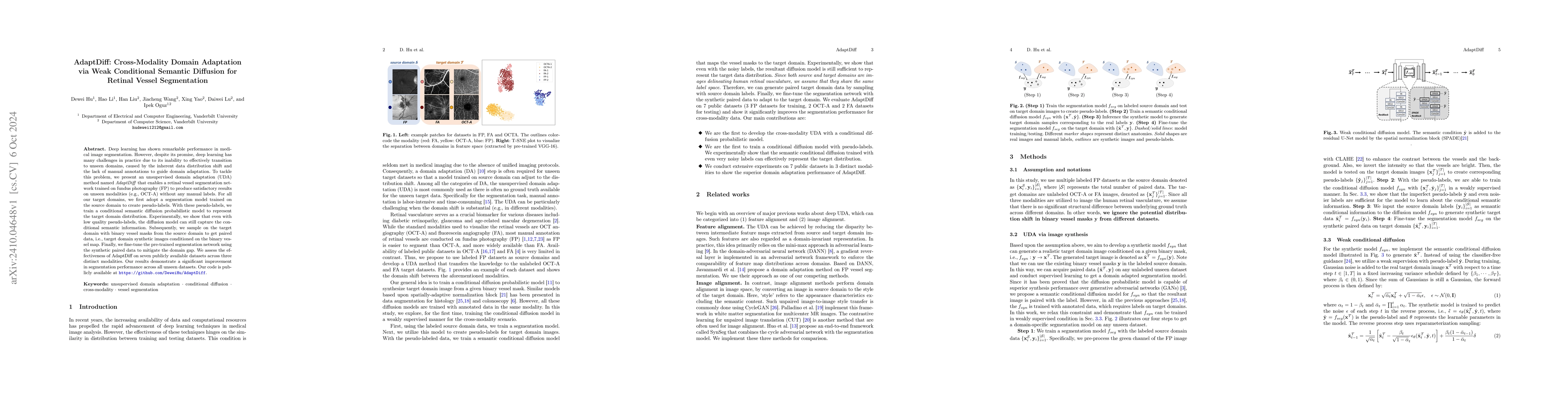 Thumbnail for AdaptDiff: Cross-Modality Domain Adaptation via Weak Conditional
  Semantic Diffusion for Retinal Vessel Segmentation